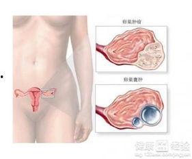 卵巢癌术后可以吃方瓜吗,方瓜的适宜摄入探讨