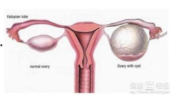 卵巢癌术后可以吃方瓜吗,方瓜的适宜摄入探讨